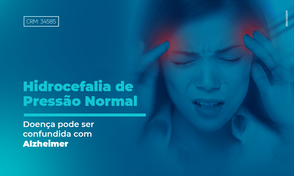 Hidrocefalia De Pressão Normal Neurologia Clínica 4502